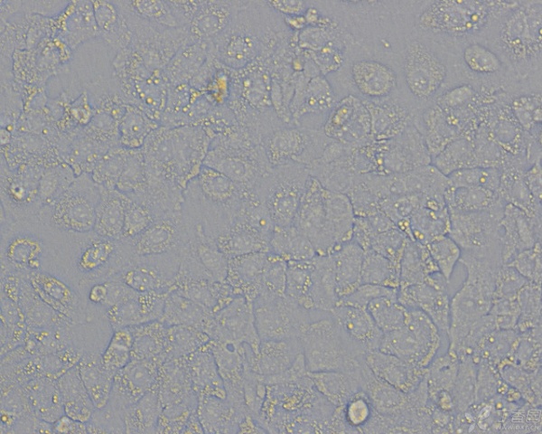 请大神帮忙瞧一下我的huh7细胞形态正常吗