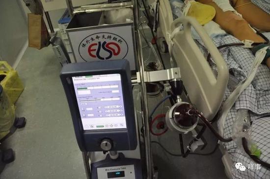 ECMO