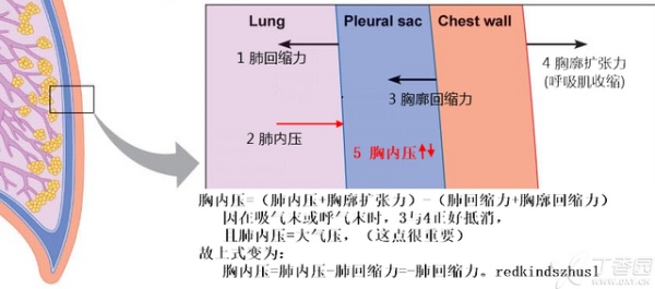 胸膜腔内压的方向到底是怎么样的